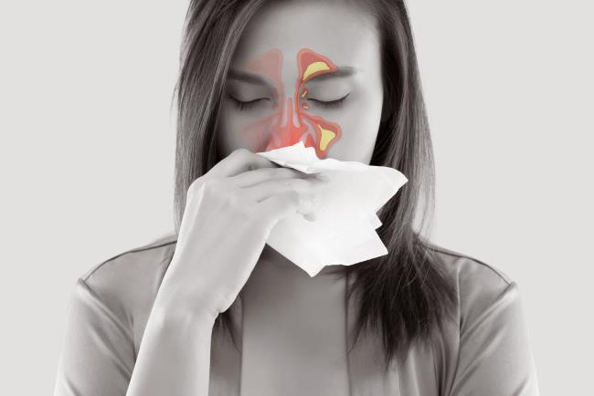 אישה מקנחת את האף וסובלת מסינוסיטיס